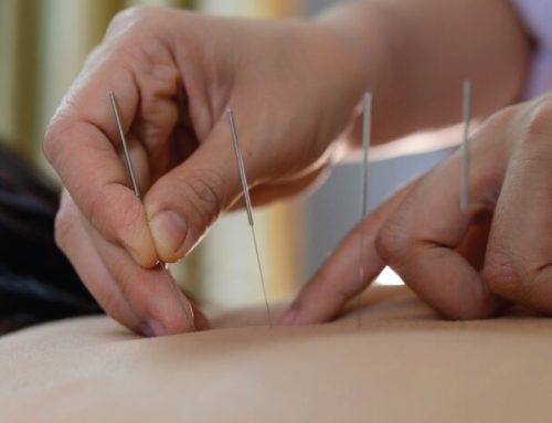 How Does Acupuncture Work to Relieve Pain?